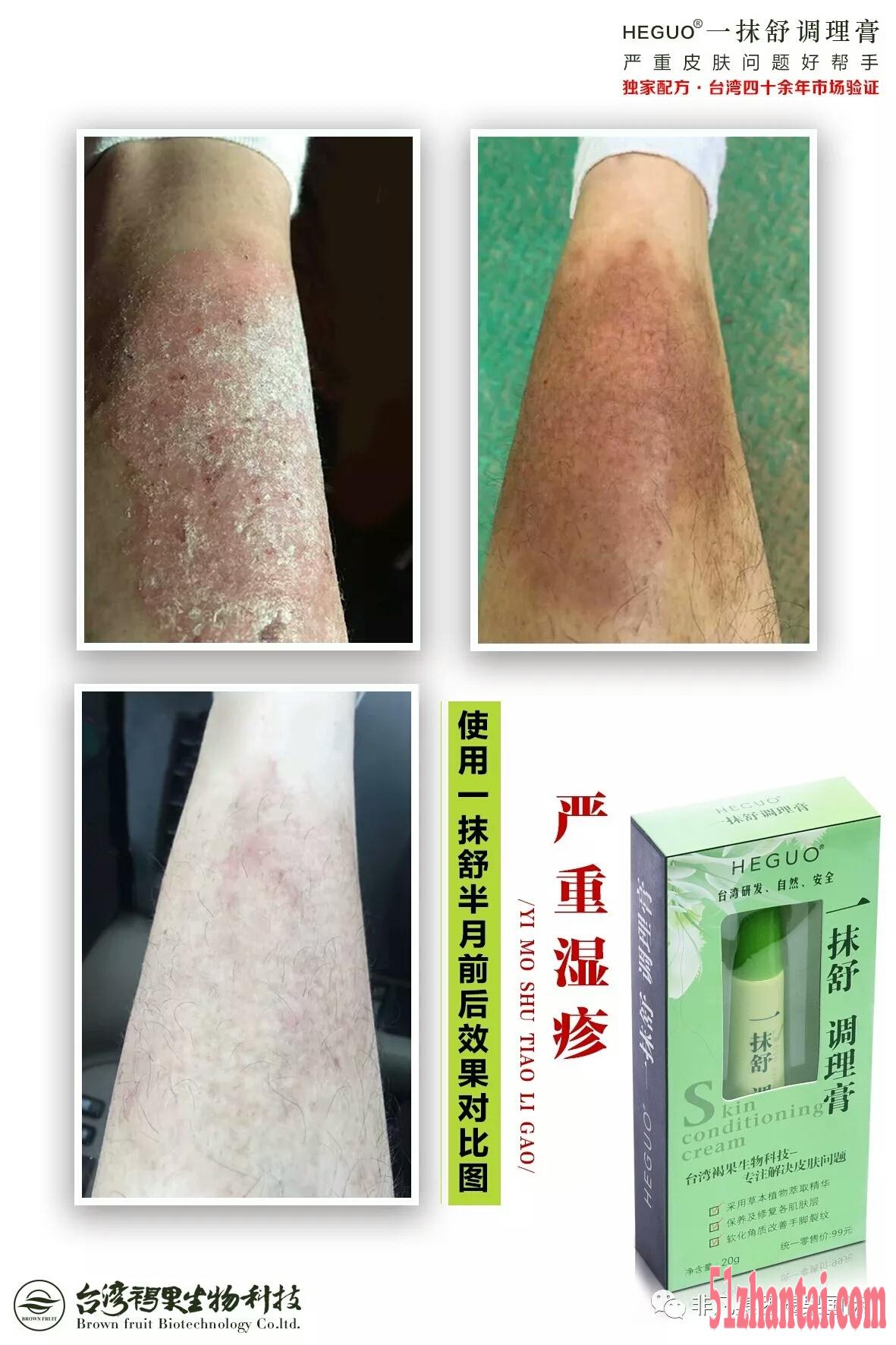 台湾褐果一抹舒调理膏专注您的皮肤健康-图2