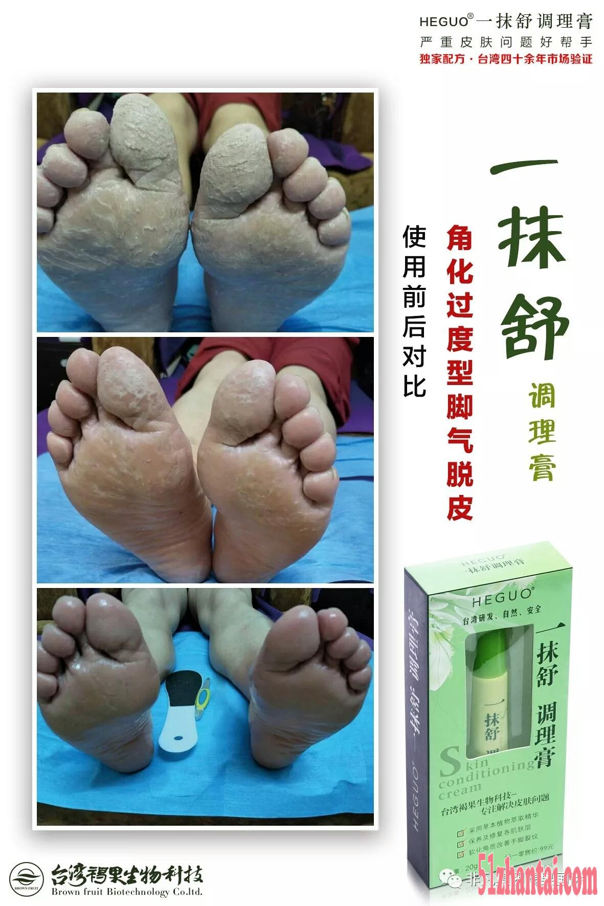 台湾褐果一抹舒调理膏专注您的皮肤健康-图3